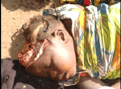 biafran child murdred.