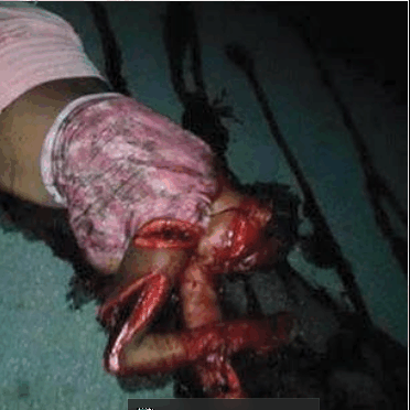 biafran-woman-buchered, slaughtered by Nigerians