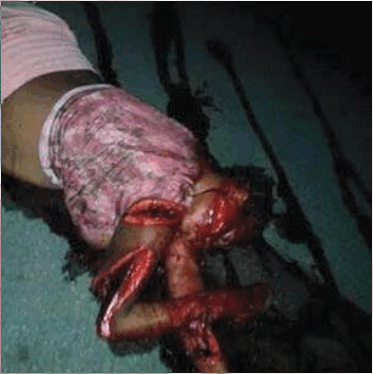 A Biafran buchared by notherners for being a biafran