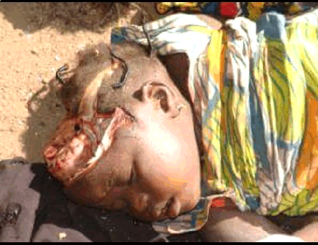 a biafran child, head distroyed